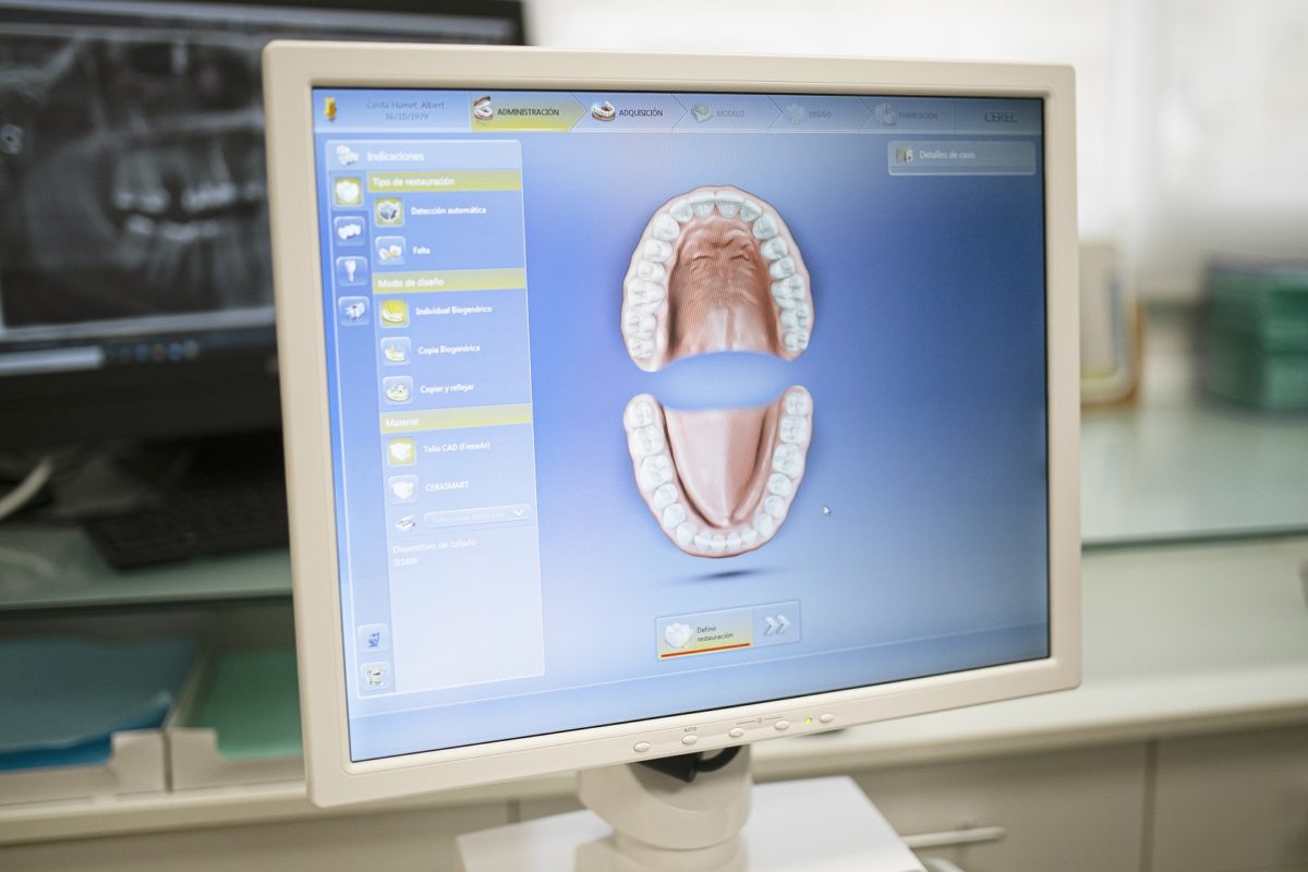 CEREC 3D CAD CAM dentistry palamos girona