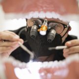 Dental restorations