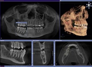 orthodontics